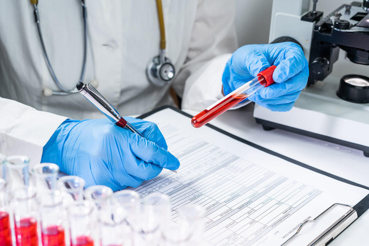 blood test for cancer diagnosis laboratory